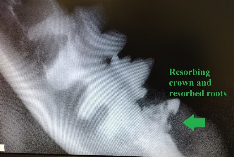The Importance of Dental Radiographs
