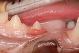 Dental Resorptive Lesions